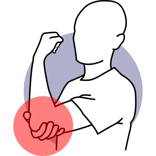 Elbow Pain — pain treatment illustration, Dr. MKB Tanveer, Dhaka