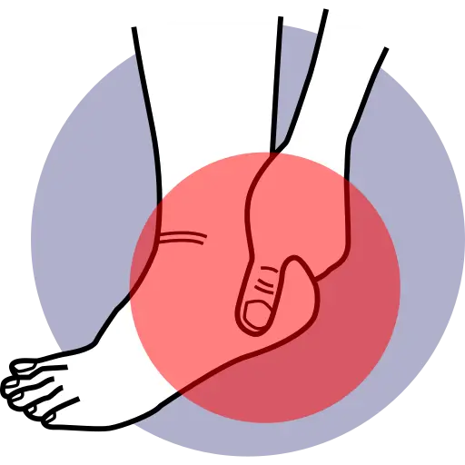 Heel Pain — pain treatment illustration, Dr. MKB Tanveer, Dhaka