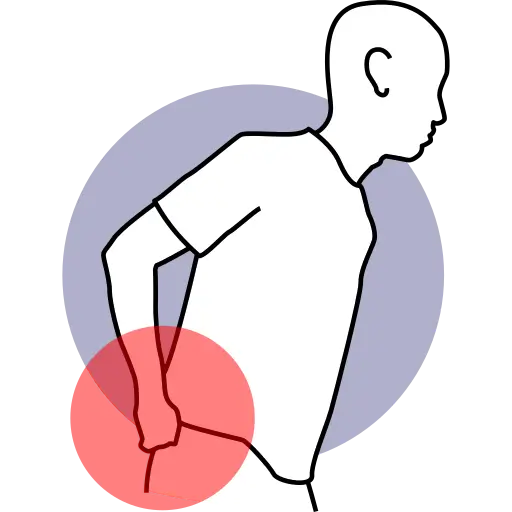 Pain in the Back of the Leg (Hamstring / Nerve Area) — pain treatment illustration, Dr. MKB Tanveer, Dhaka