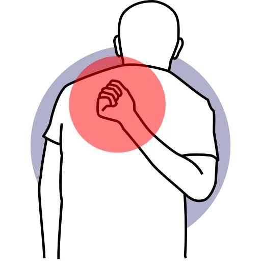 Pain in the SI Joints (Lower Back / Hip Area) — pain treatment illustration, Dr. MKB Tanveer, Dhaka