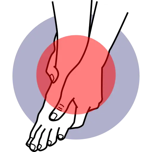 Pain in the Sole of the Foot — pain treatment illustration, Dr. MKB Tanveer, Dhaka